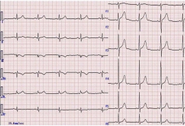 Khám tim mạch và đo ECG cho sản phụ