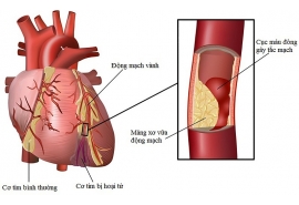 Khám và sàng lọc các bệnh nhi có nguy cơ bệnh lý về tim mạch, rối loạn nhịp tim.